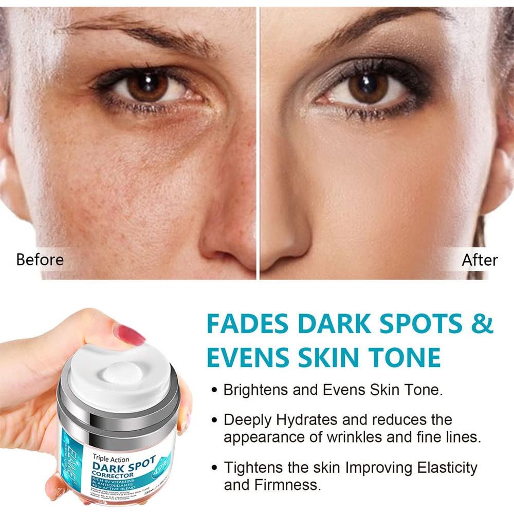 Removedor de Manchas Oscuras SWETIYOU 160g - Unifica Tono Piel