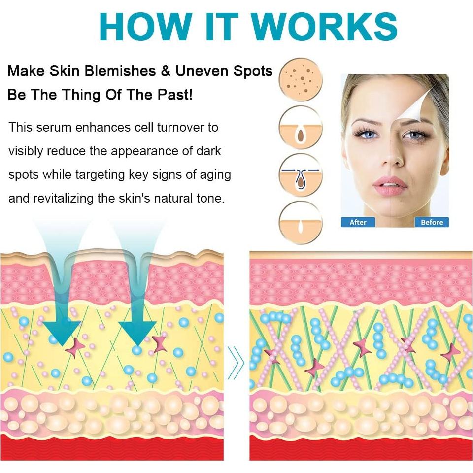 Removedor de Manchas Oscuras SWETIYOU 160g - Unifica Tono Piel