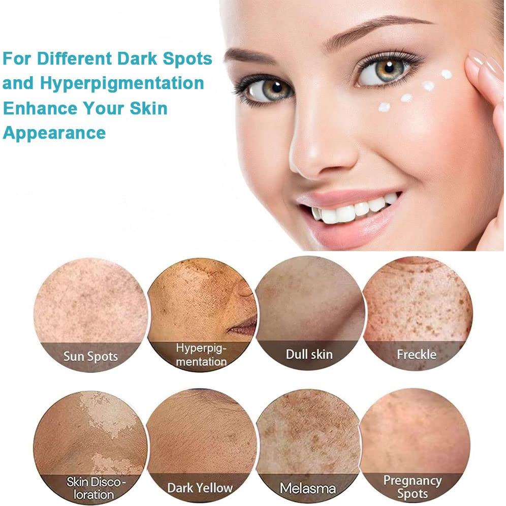 Removedor de Manchas Oscuras SWETIYOU 160g - Unifica Tono Piel