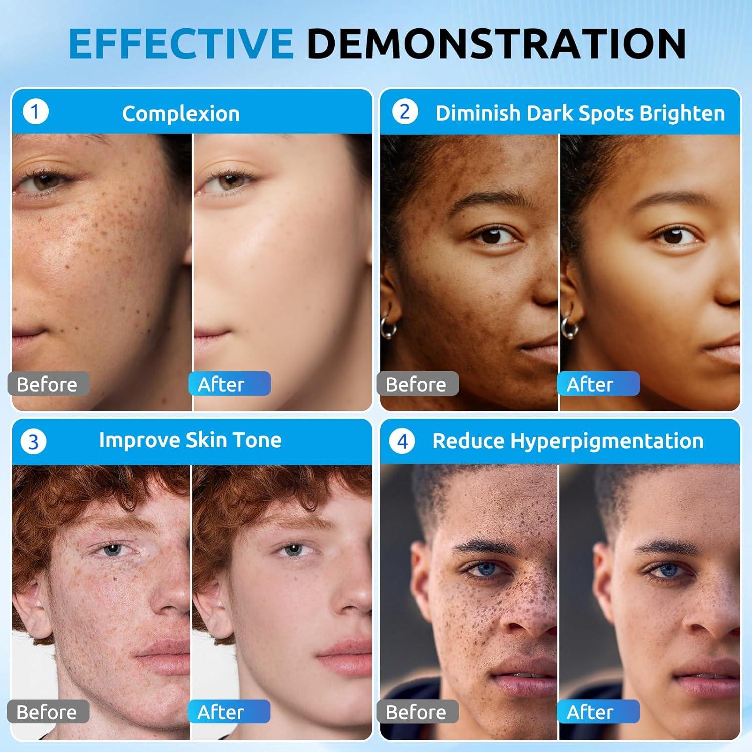 Crema Removedora de Manchas Oscuras HANYWIL 60 ml