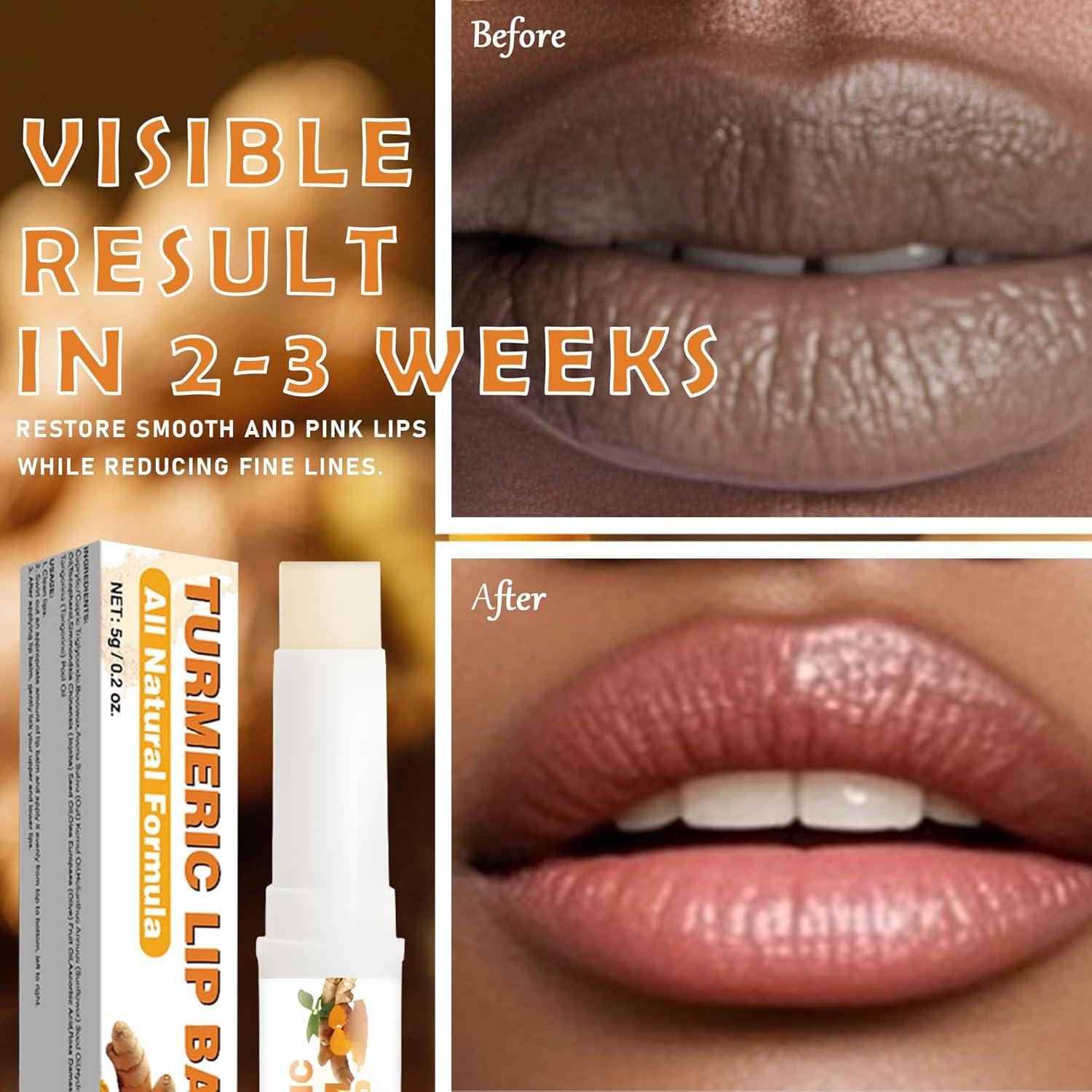 Bálsamo Labial de Cúrcuma LoisAAA 4.8g Aclarador Hidratante