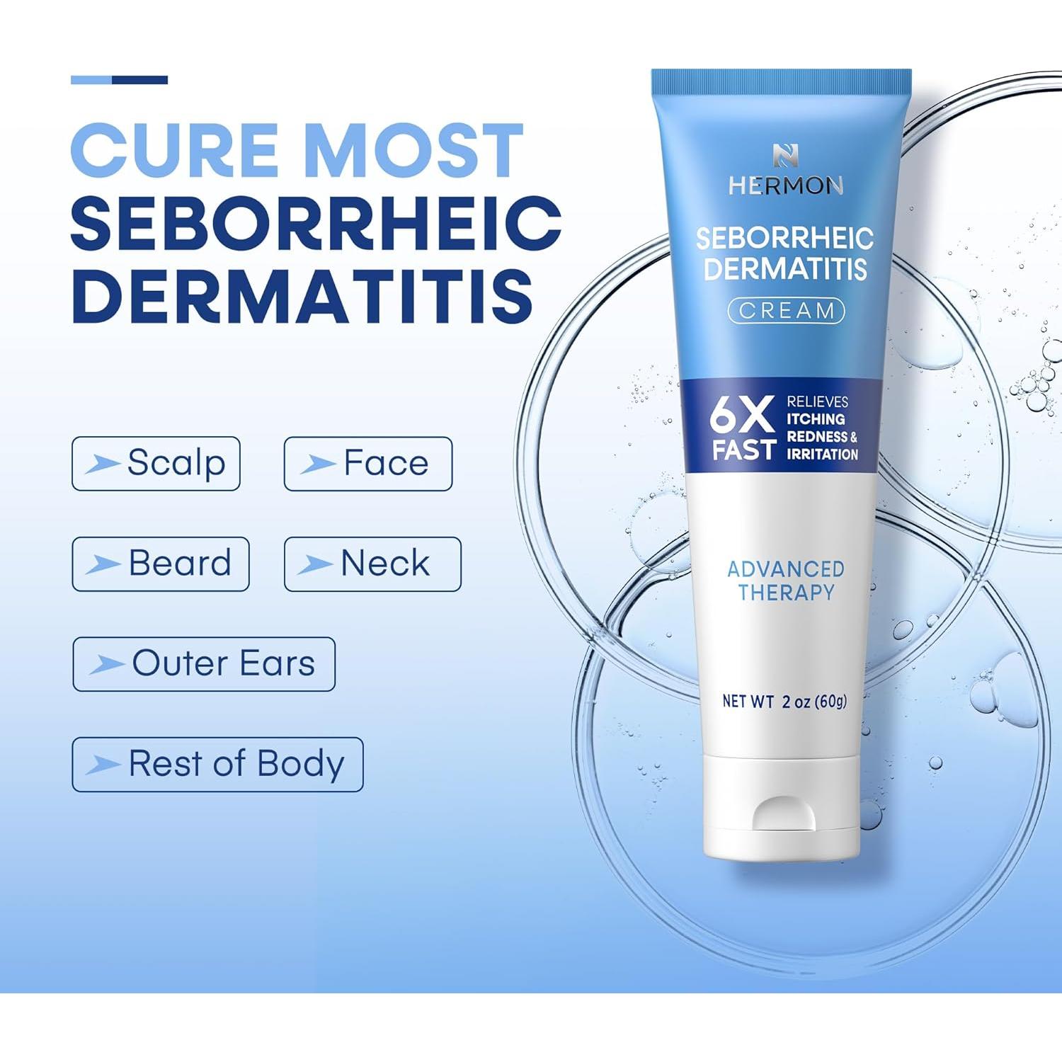 Crema Antipicazón Hermon para Dermatitis Seborreica 81.9g