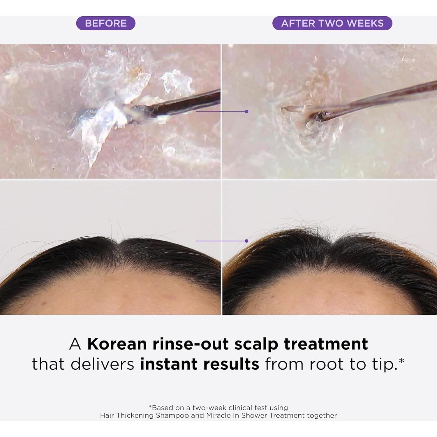 Dr. Groot Set Revitalizante Cuero Cabelludo 3 Productos