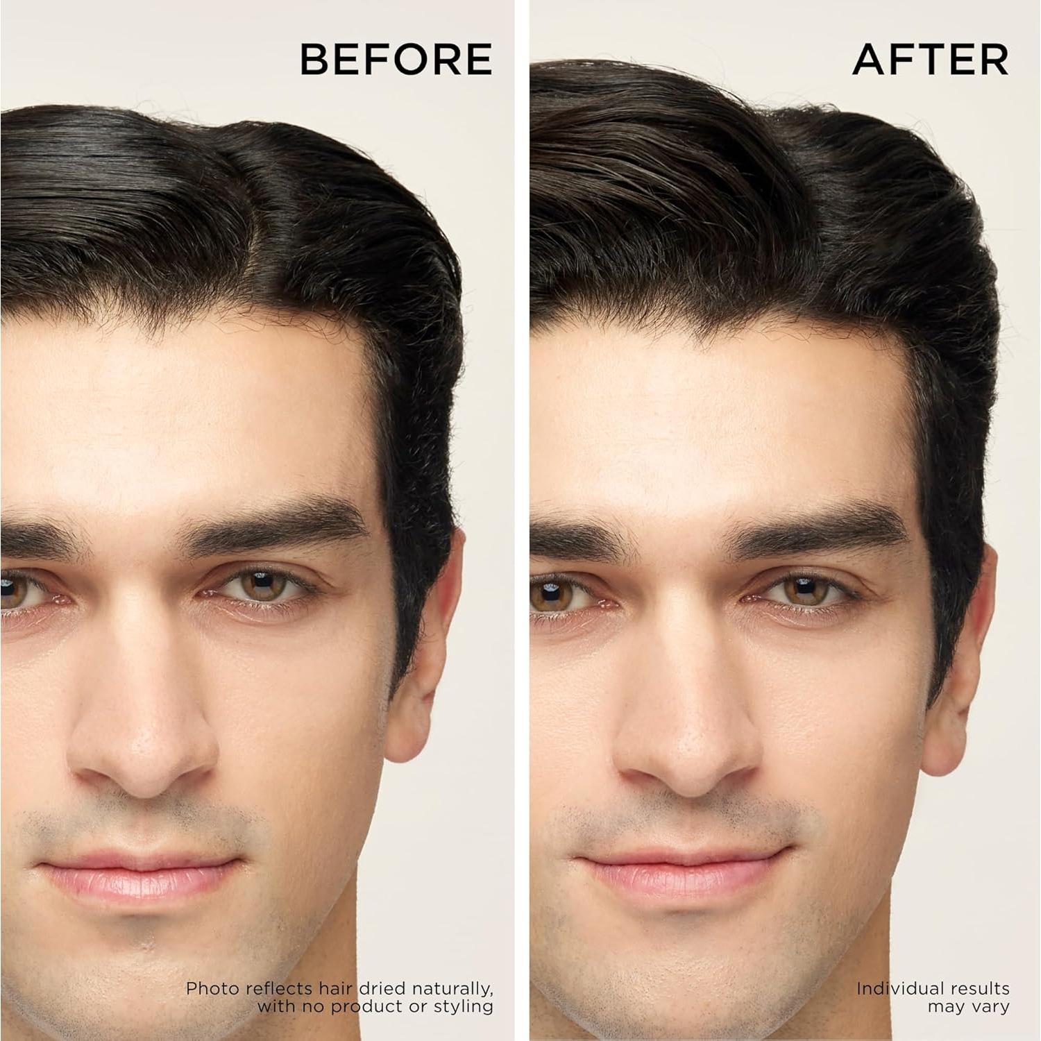 Dr. Groot Set Revitalizante Cuero Cabelludo 3 Productos