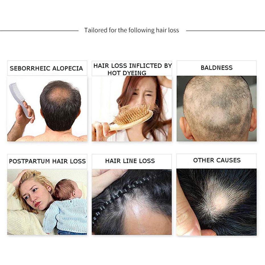 Suero Capilar Natural DISAAR BEAUTY 30g - Anti Caída y Crecimiento