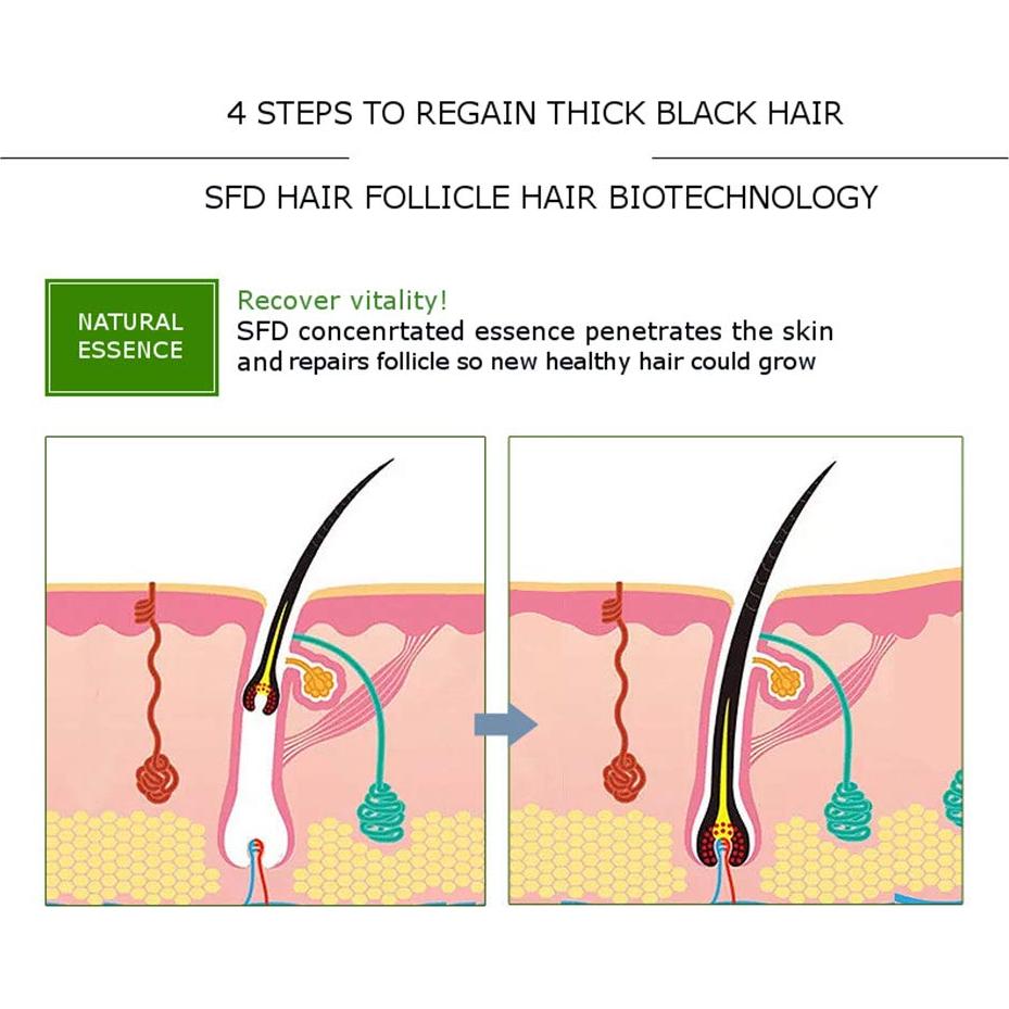 Suero Capilar Natural DISAAR BEAUTY 30g - Anti Caída y Crecimiento