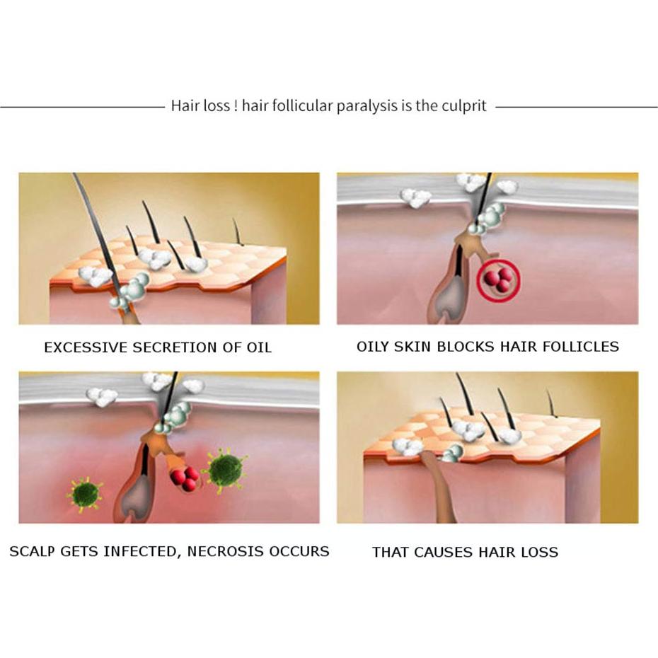 Suero Capilar Natural DISAAR BEAUTY 30g - Anti Caída y Crecimiento