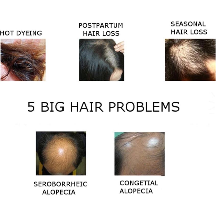 Suero Capilar Natural DISAAR BEAUTY 30g - Anti Caída y Crecimiento