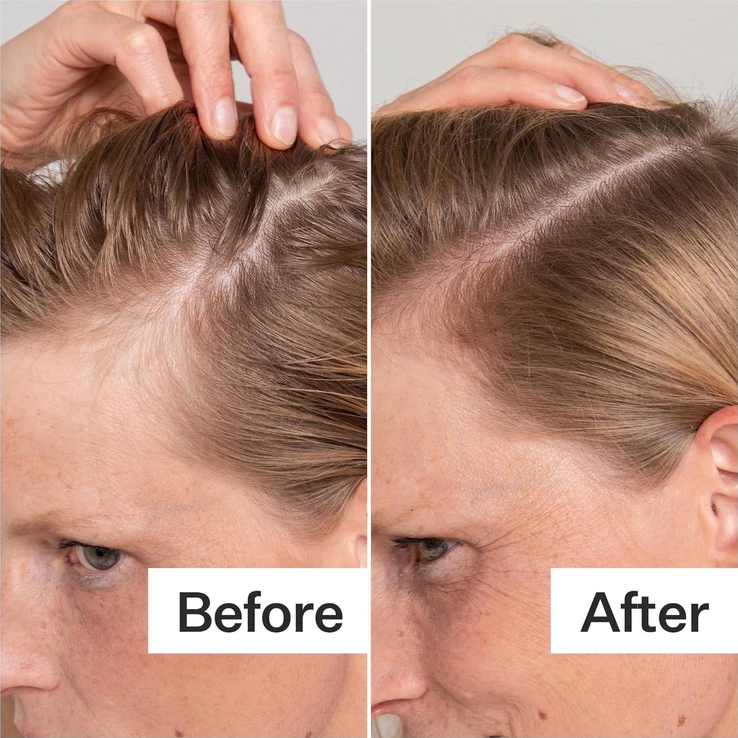 Exfoliante Cuero Cabelludo ACT+Acre 59ml | Ácido Salicílico, Papaya, Menta