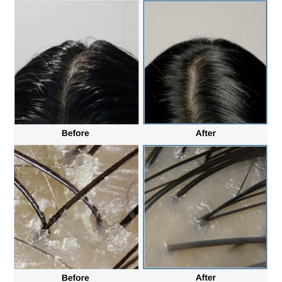 Exfoliante para Cuero Cabelludo GROWUS 120g - Sal Marina y Ácido Salicílico