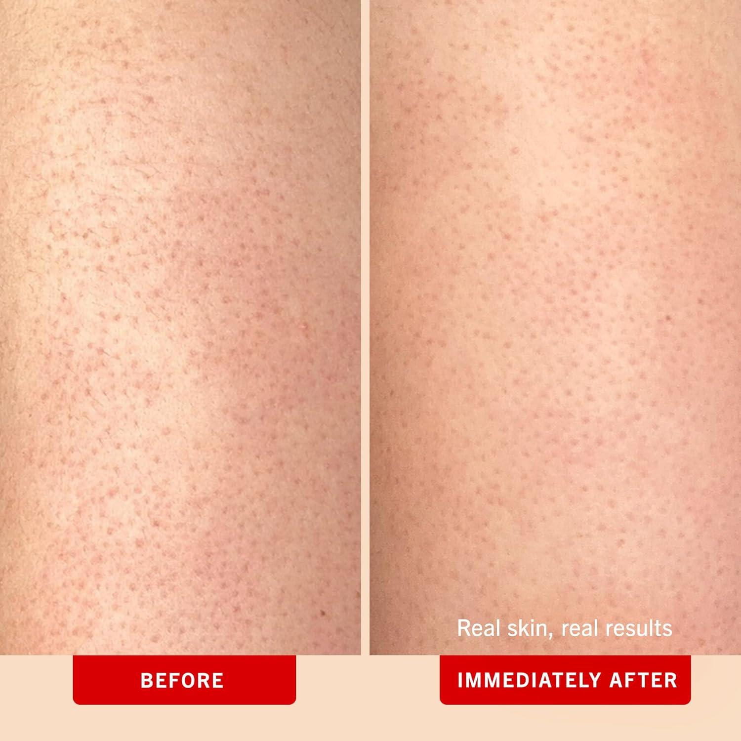 Exfoliante Corporal First Aid Beauty KP 10% AHA Durazno 226.8 g