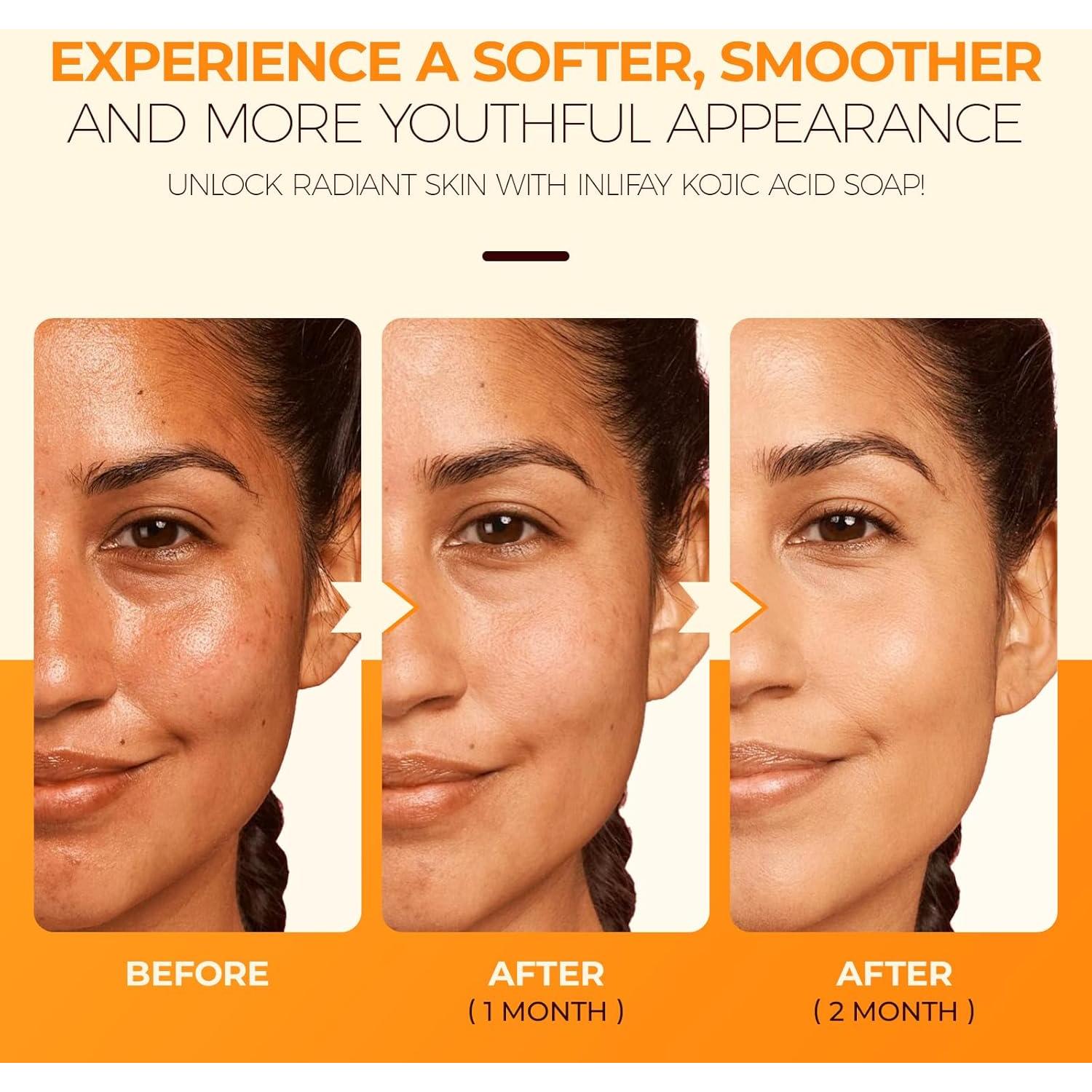 Jabón Inlifay Ácido Kojico y Cúrcuma 300g - Eliminador de Manchas