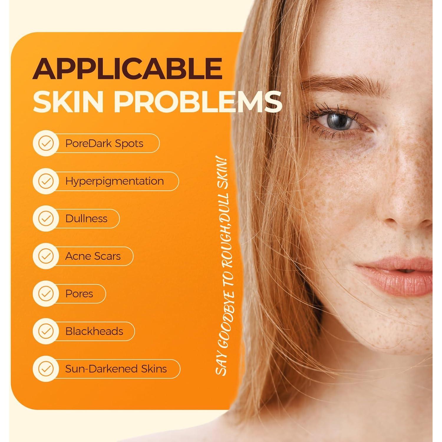 Jabón Inlifay Ácido Kojico y Cúrcuma 300g - Eliminador de Manchas