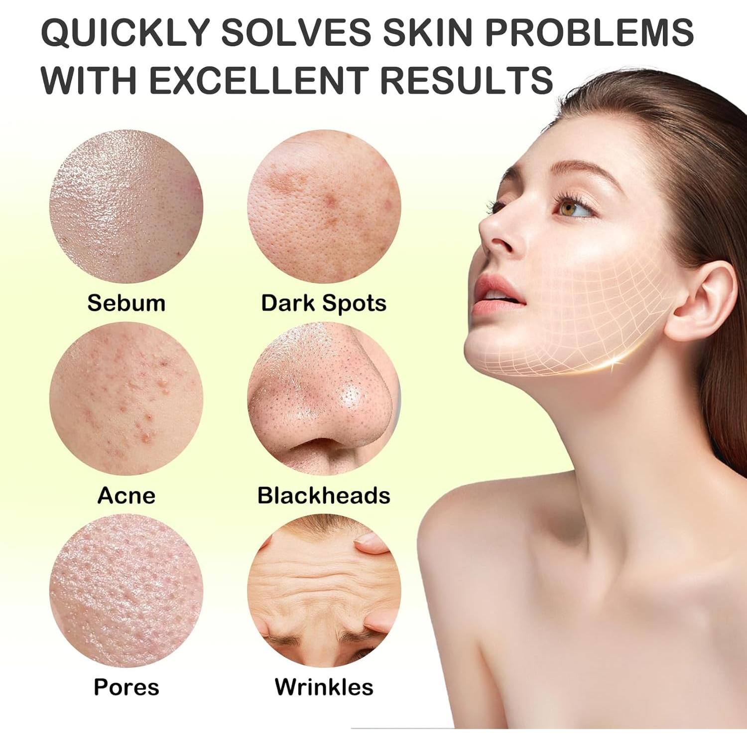 Set de 24 Mascarillas Faciales de Arcilla LZYLLS Hidratantes