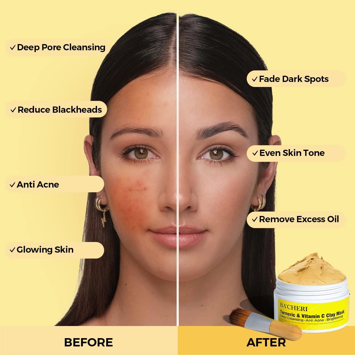 Mascarilla de Arcilla BACHERI con Cúrcuma y Vitamina C 130g
