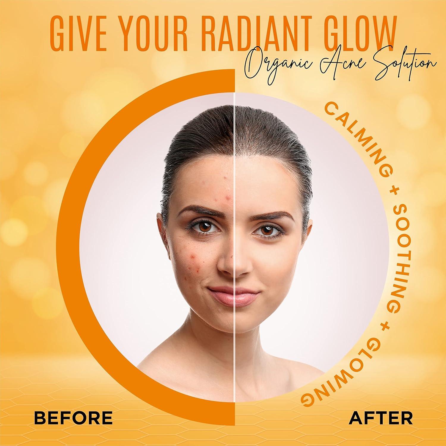 Jabón de Cúrcuma Orgánica Dermaxgen 99.22 g - Cuidado Piel