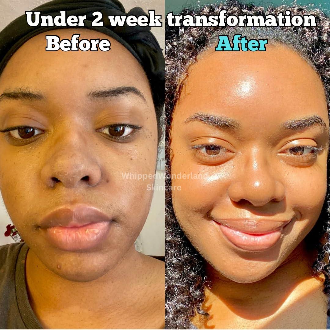 Jabón de Cúrcuma Hello Clear Skin - Whipped Wonderland, 156g