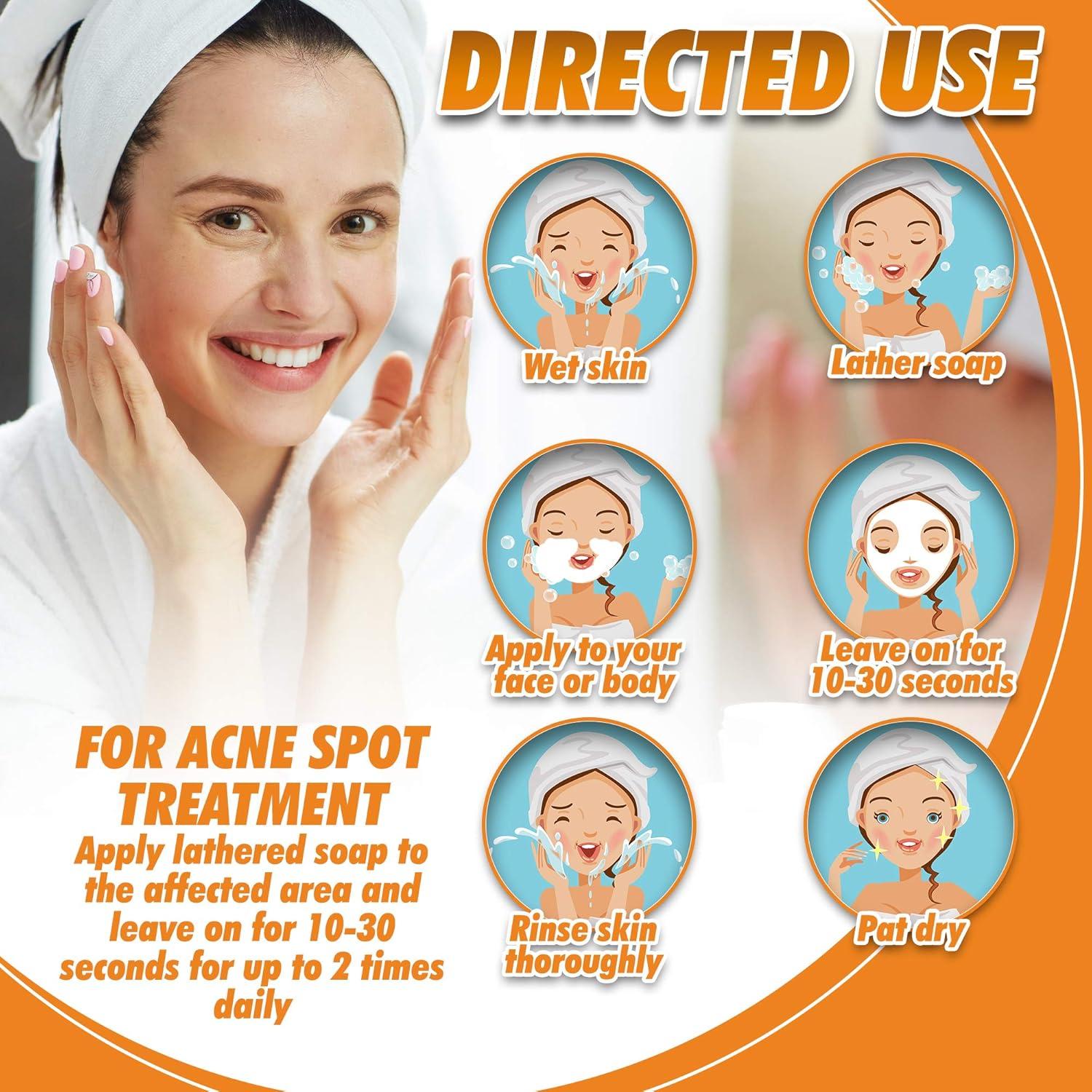 Jabón Natural de Cúrcuma Herblov 159g - Ilumina Piel y Reduce Acné