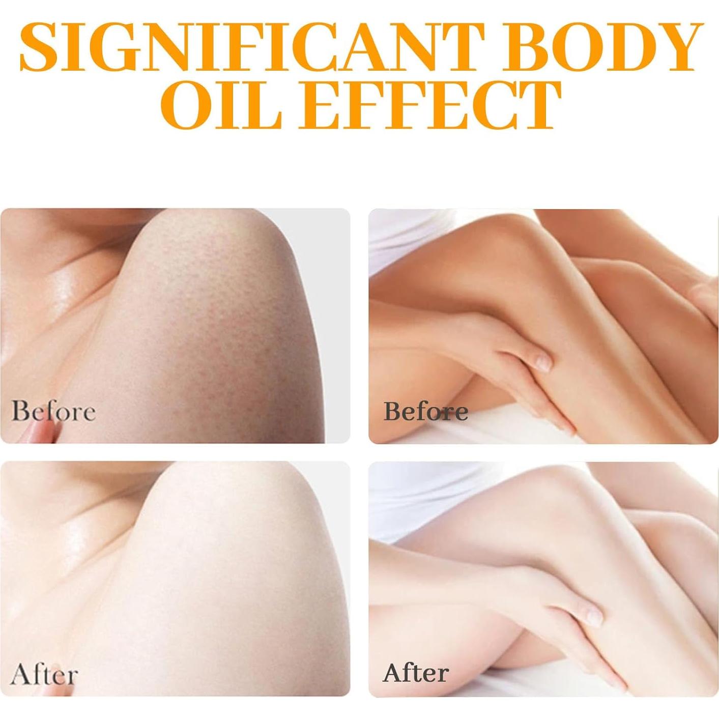 Aceite Corporal Hlonns 1000ml Cúrcuma Hidratante Natural