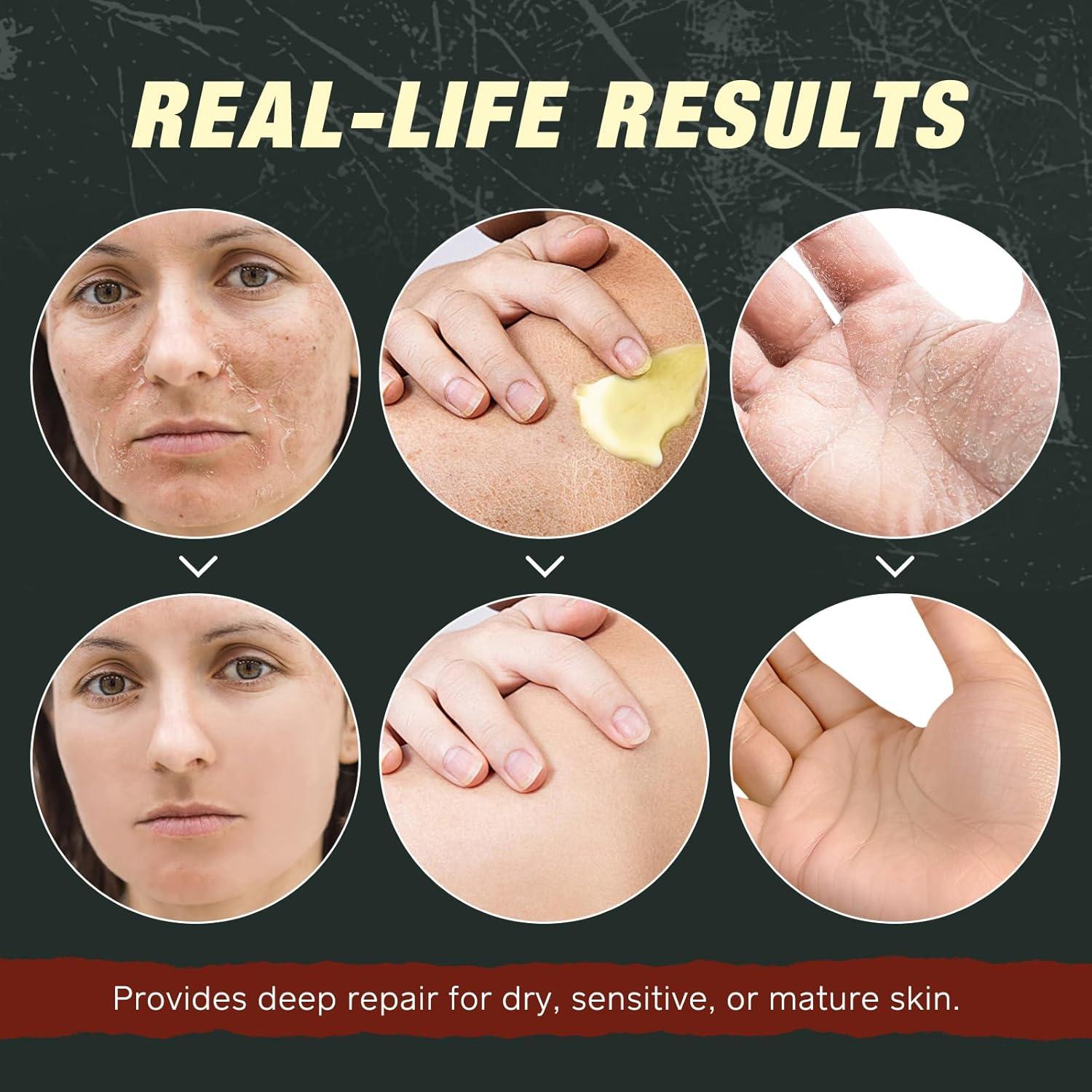 Bálsamo Hidratante Orgánico ZIXBMHYJ con Aceite de Ricino 150g