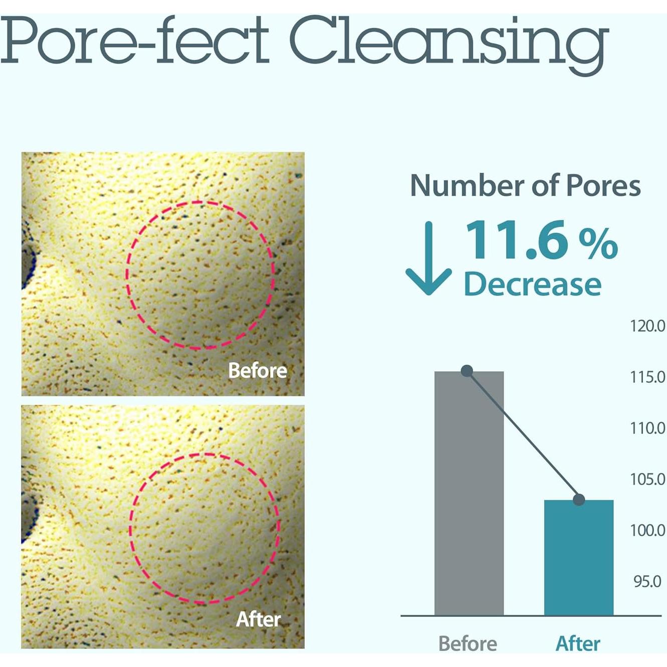 Mascarilla Burbujeante Splash Blithe 118 ml - Cuidado de Poros