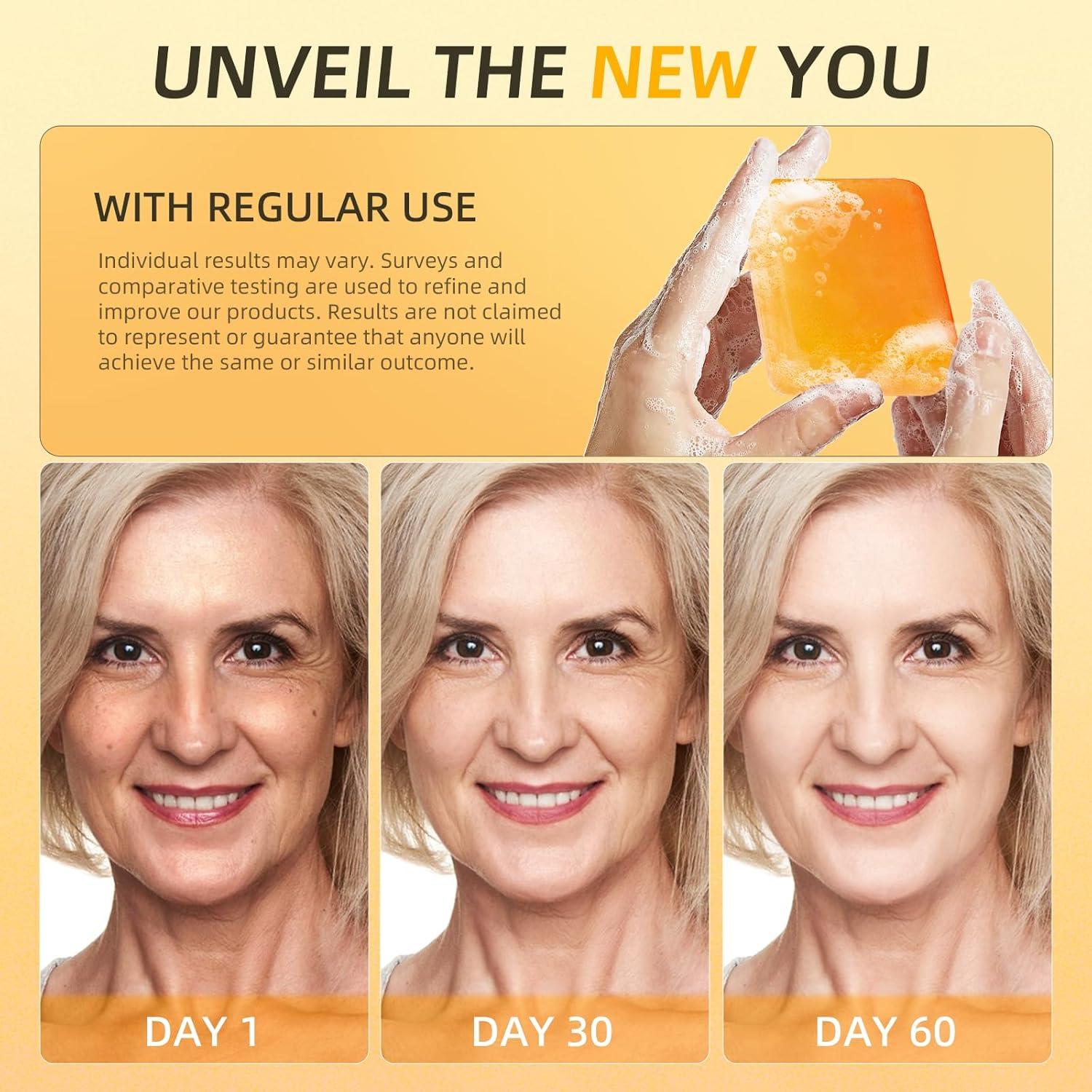 Jabón de Cúrcuma Senzilo 4 Barras 105g - Ácido Kójico, Colágeno