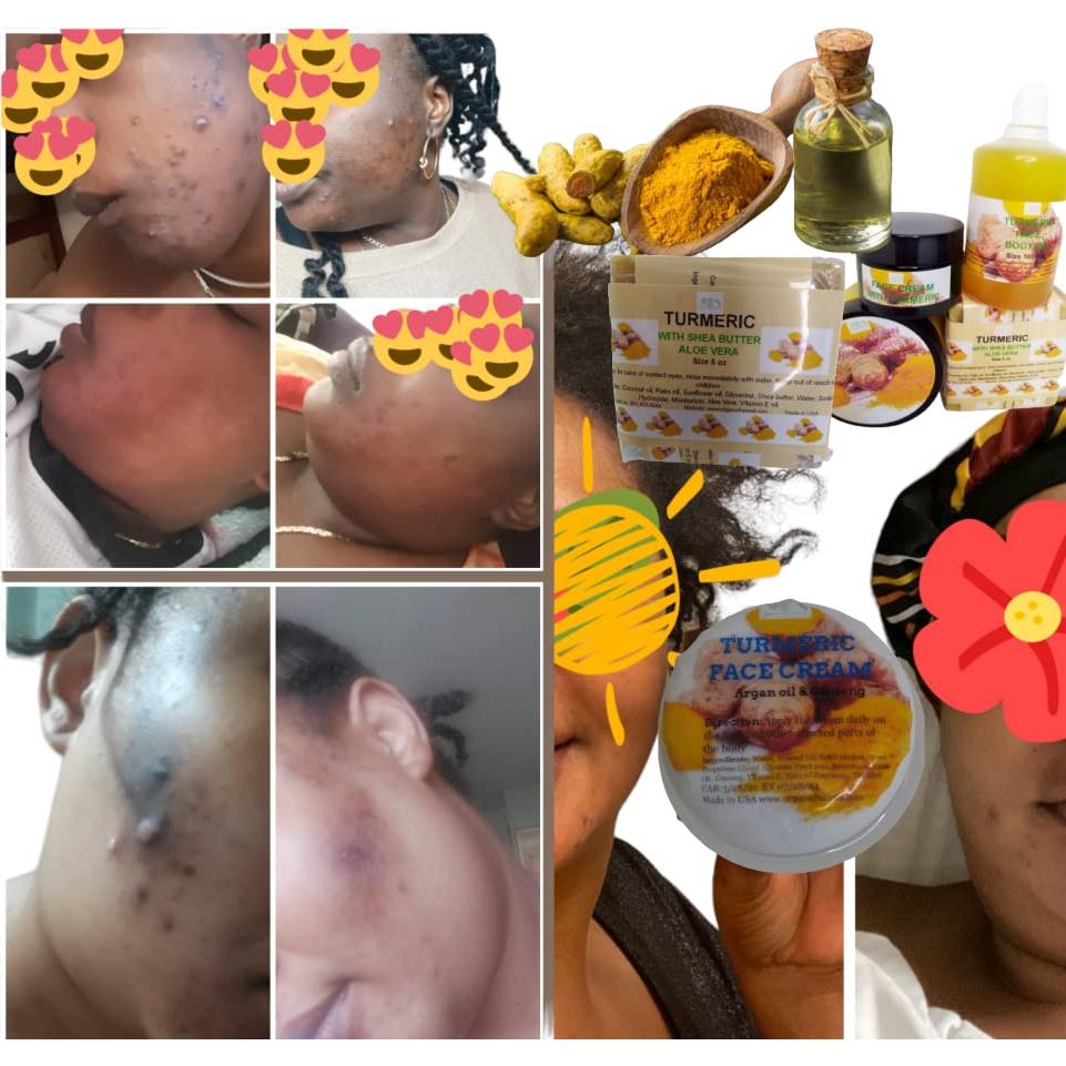 Jabón de Cúrcuma Orgánica con Aloe Vera - 2 Paquetes de 141g