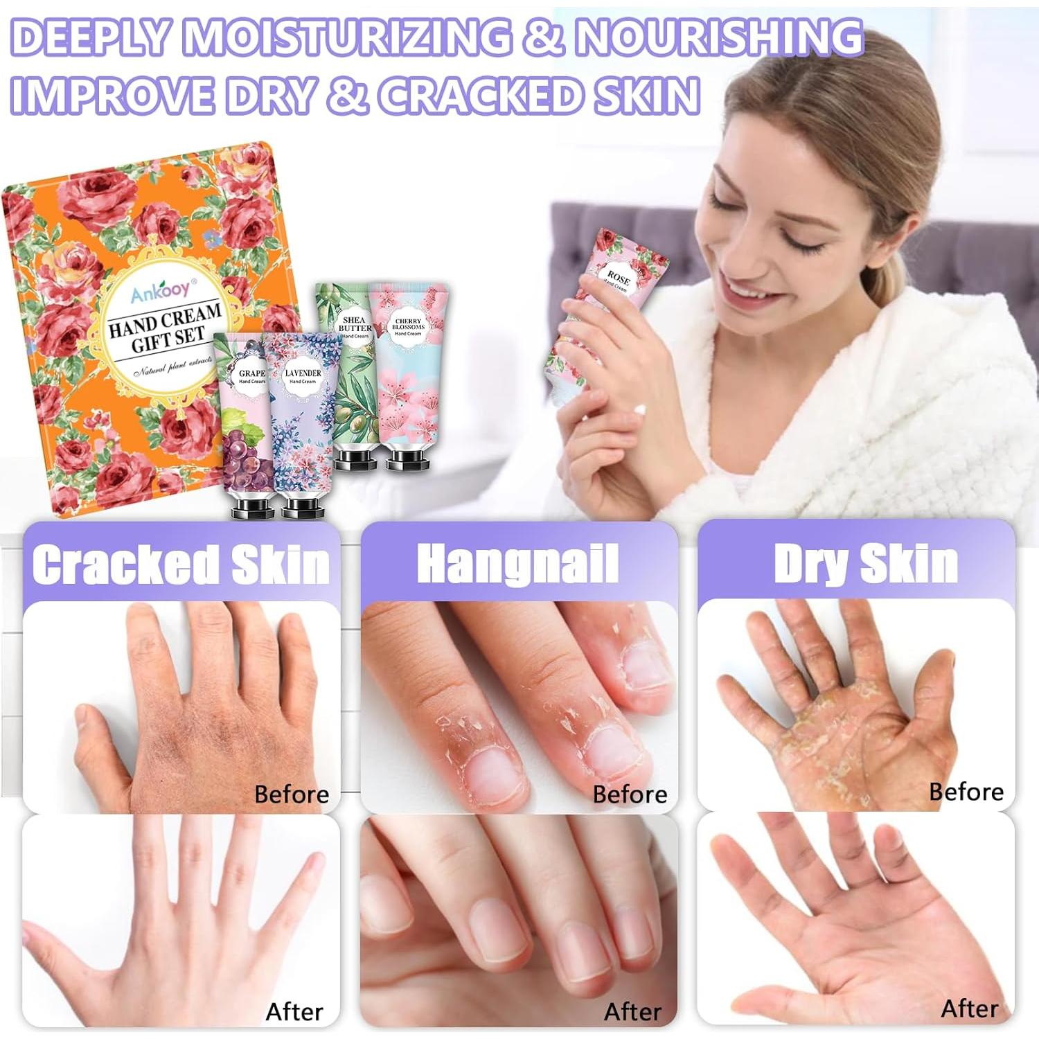 Set de 10 Cremas de Manos Naturales CMWGKBC - Hidratación Profunda