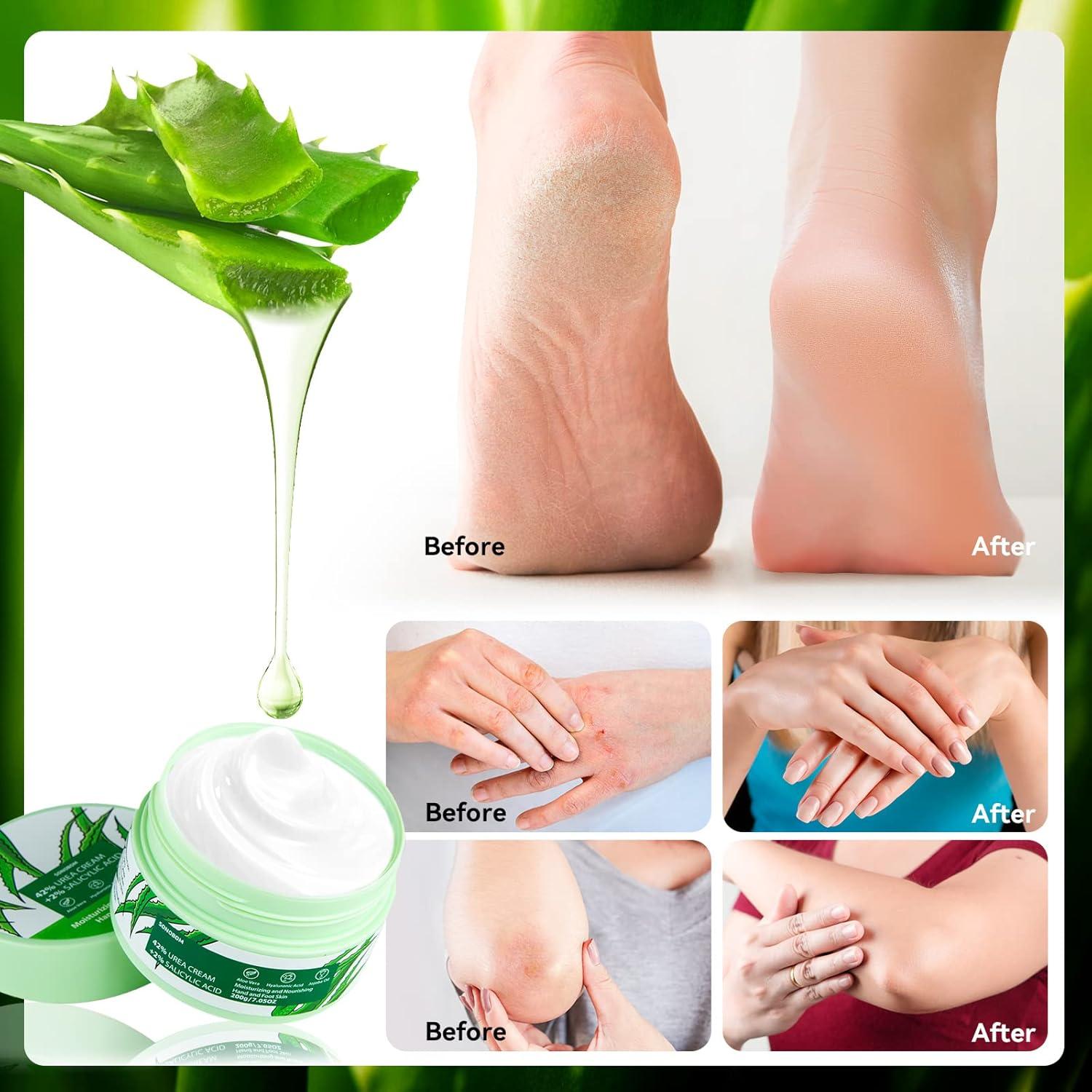 Crema de Urea 42% con Ácido Salicílico y Aloe Vera 198g