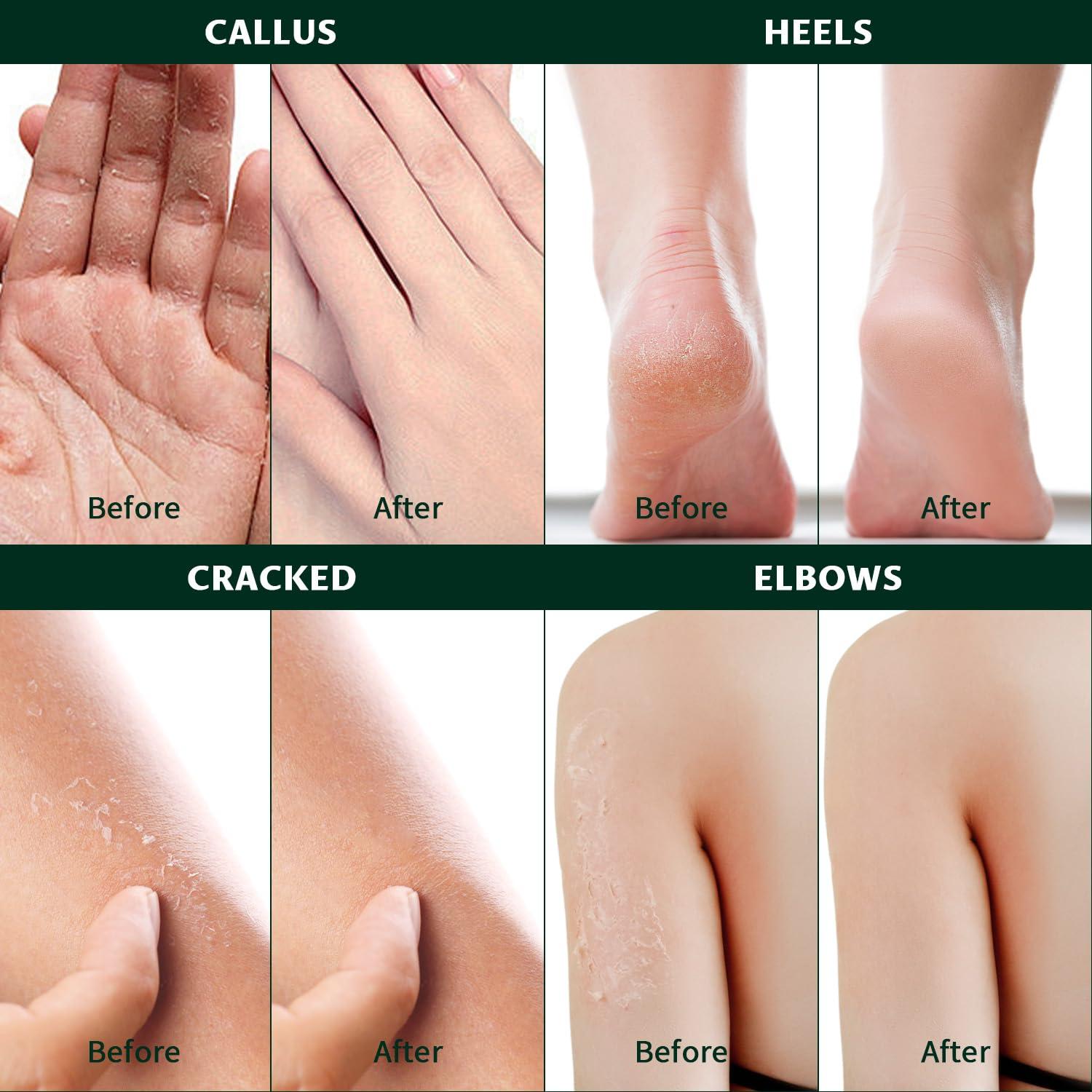 Crema de Urea 60% Danliss con 2% Ácido Salicílico 75 g