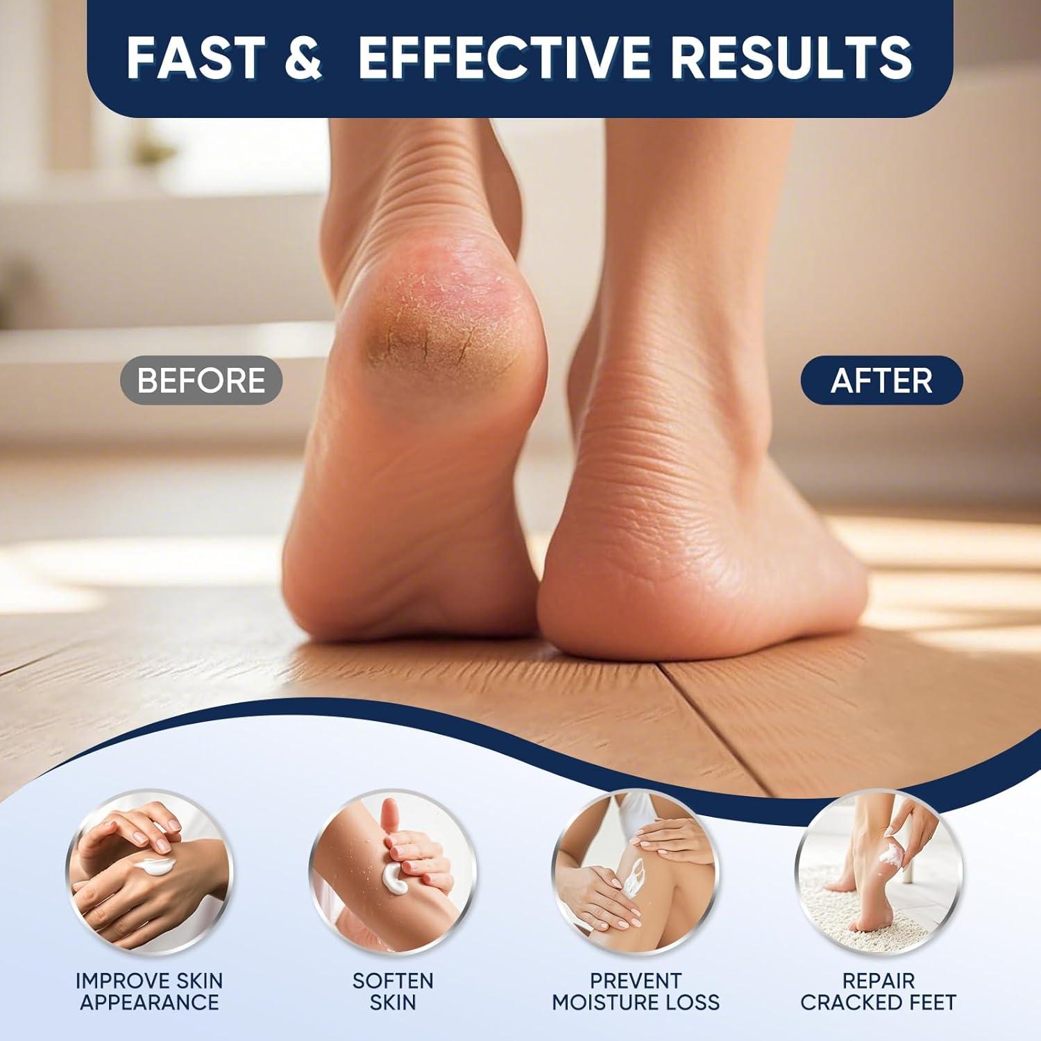 Crema de Urea 40% VREKEF para Pies y Manos 230g