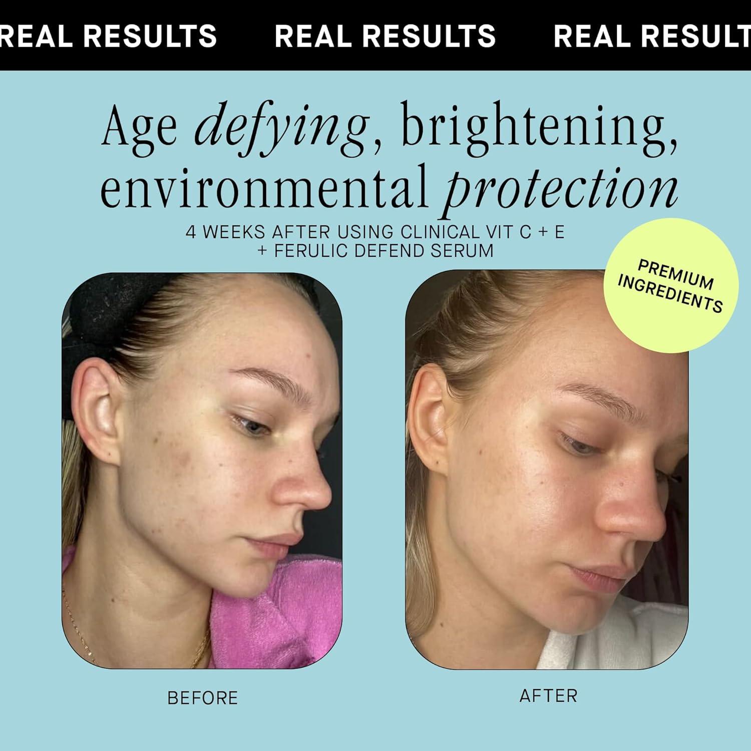 Suero Facial Vitamina C Brandefy 15% Antienvejecimiento 28g