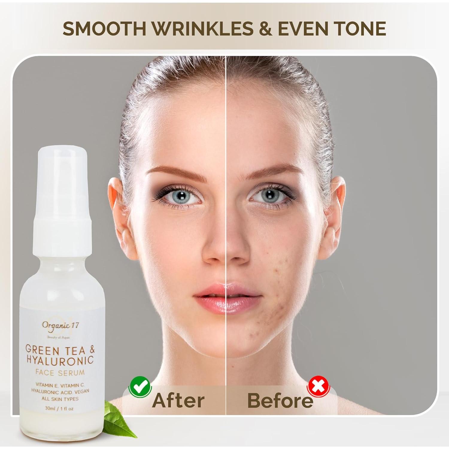 Suero Facial Hidratante 30ml 01 Organic 17 Ácido Hialurónico Té Verde