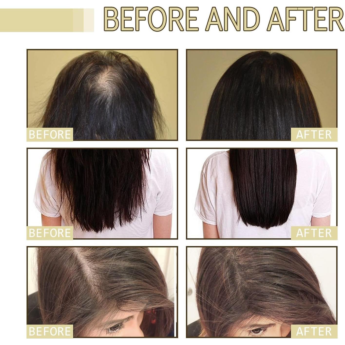 Aceite Natural para Crecimiento del Cabello ZIXGIAH 120ml Vegano