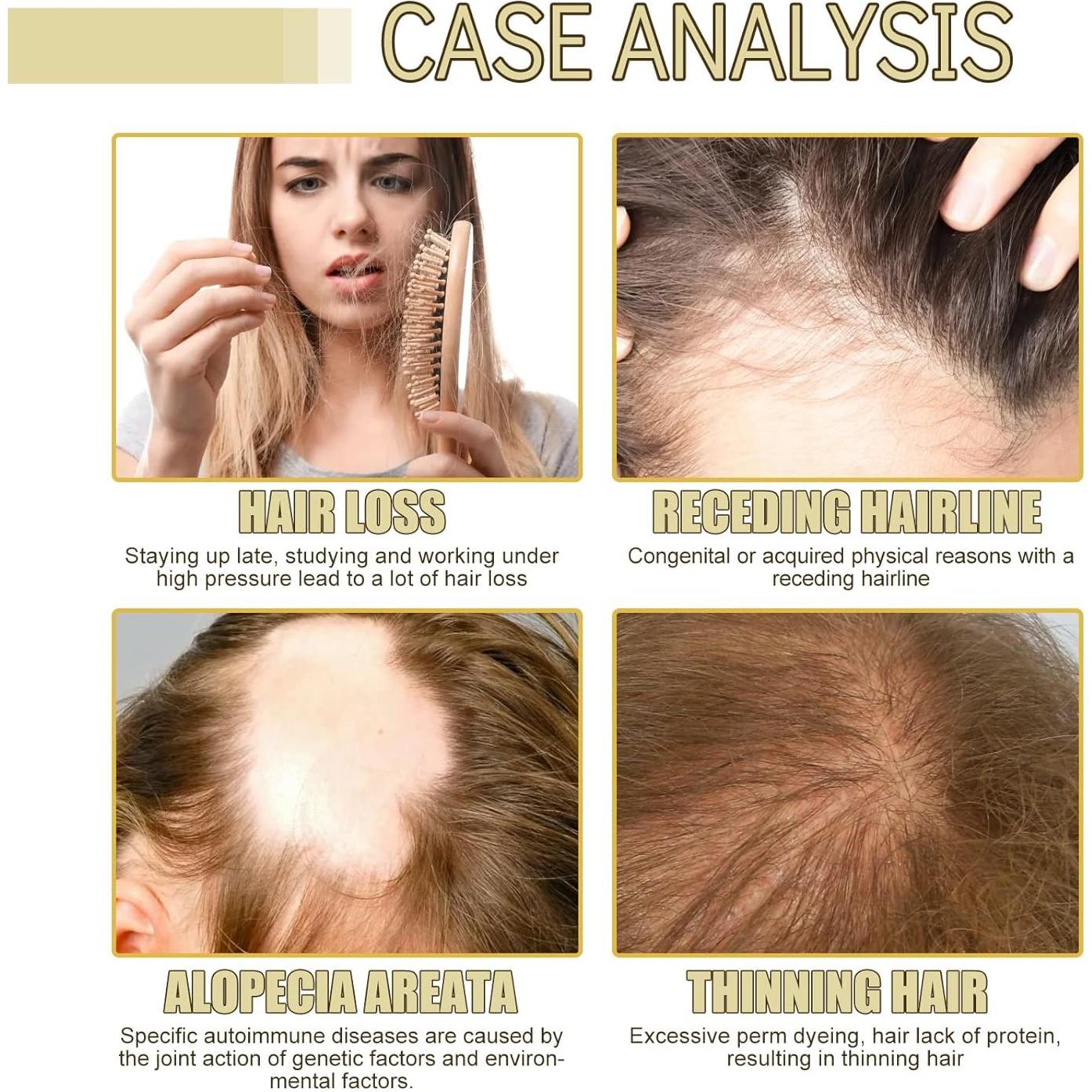 Aceite Natural para Crecimiento del Cabello ZIXGIAH 120ml Vegano