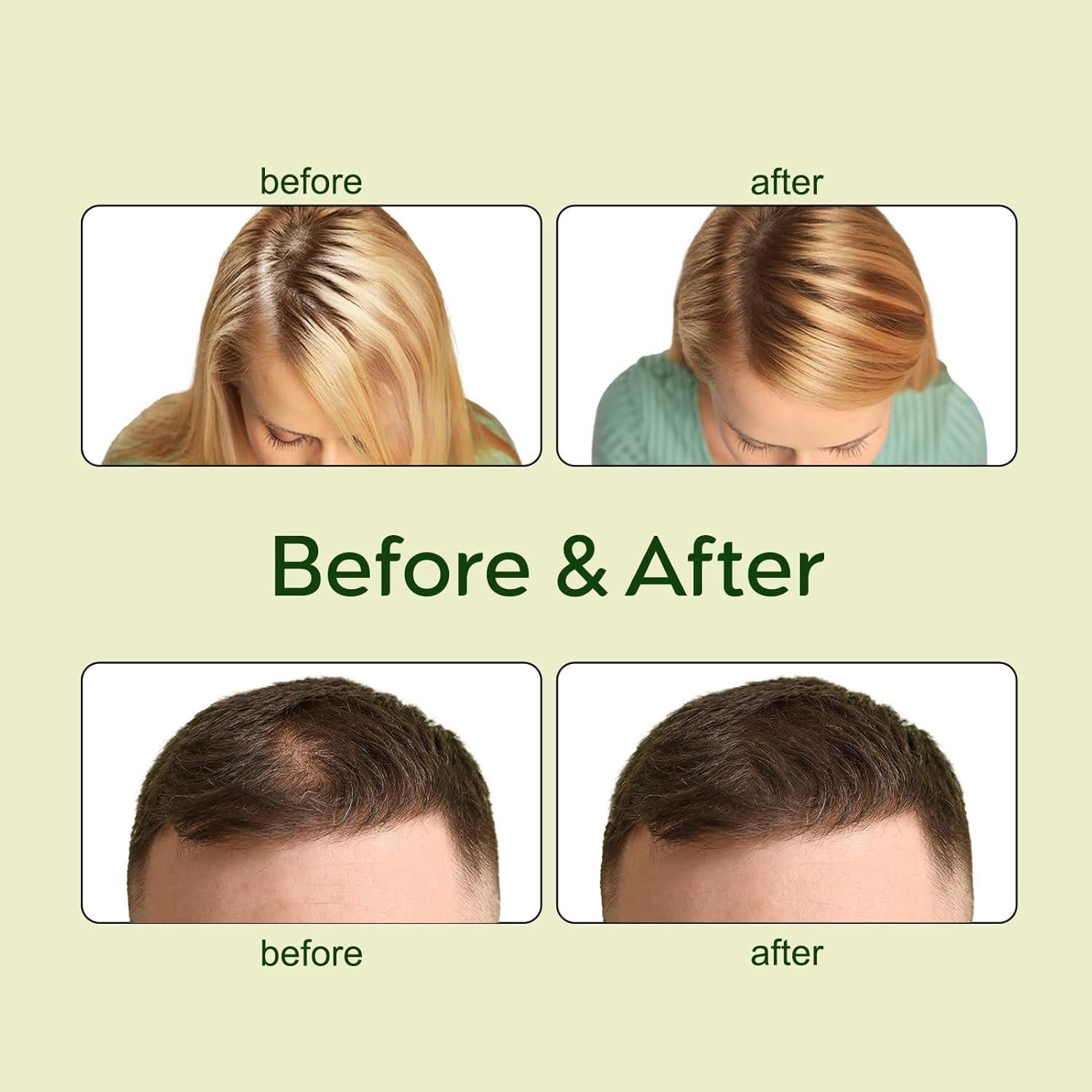 Aceite Natural Veganic para Crecimiento del Cabello 60ml