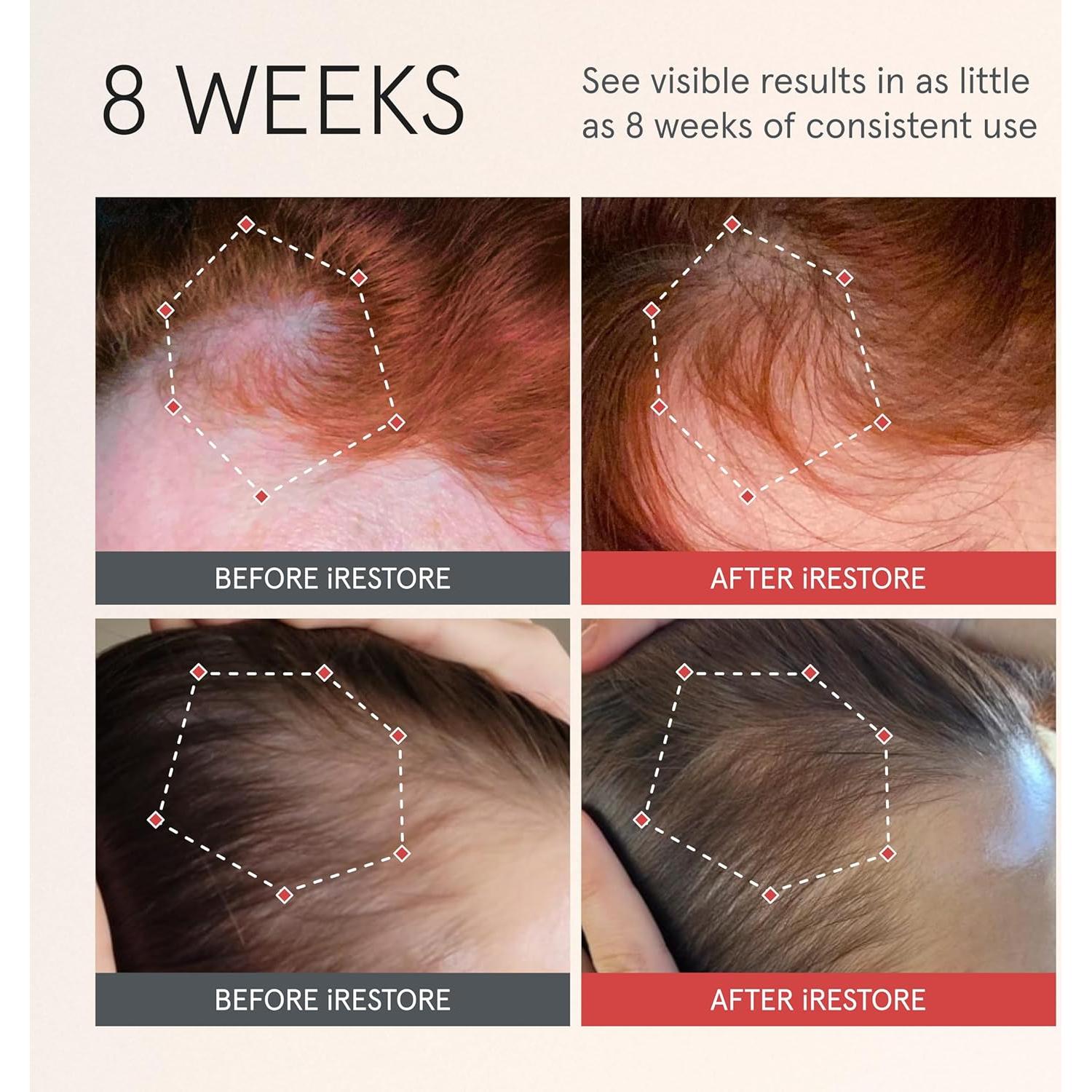 Suero Activador de Crecimiento iRestore 177 ml | Hidratante