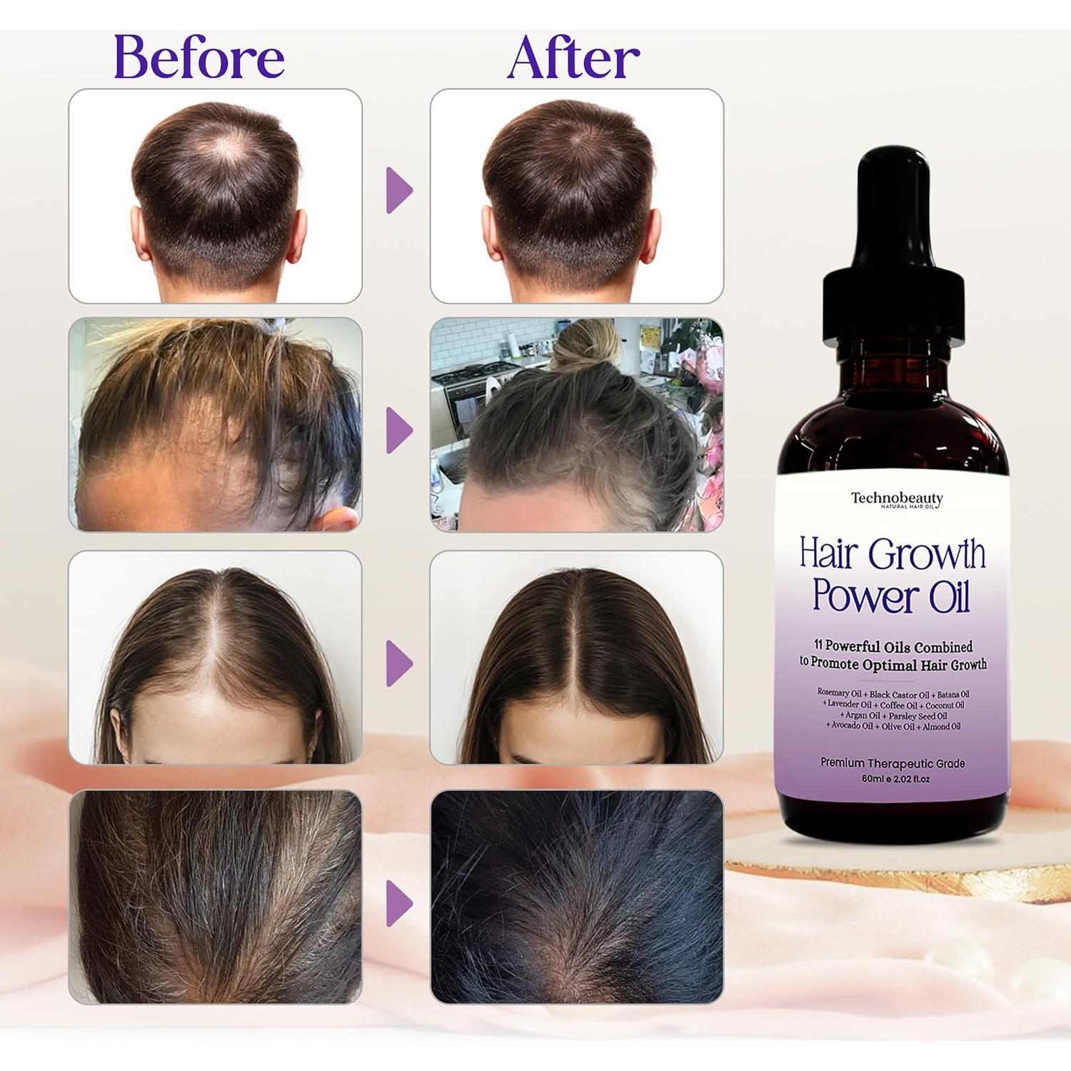 Aceite para el Cabello Super World Mart - 11 Aceites Naturales