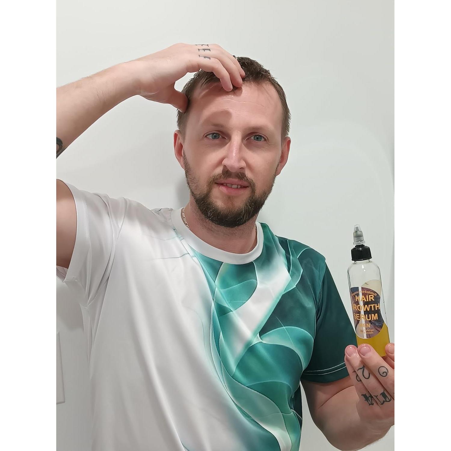 Suero de Crecimiento Capilar Orgánico para Hombres - 113.4 g