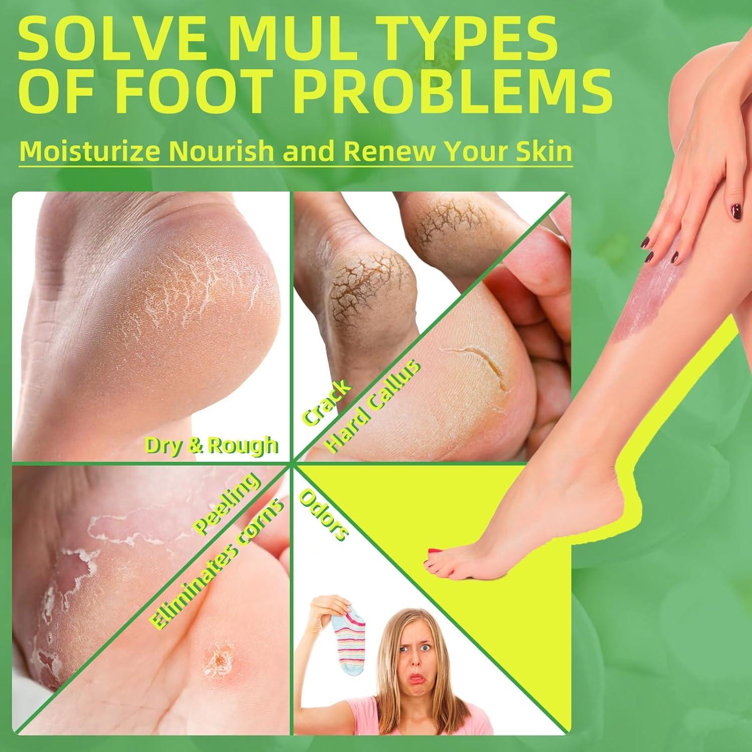 Exfoliante para Pies nbc BeautiLab Jazmín 16 Paquetes