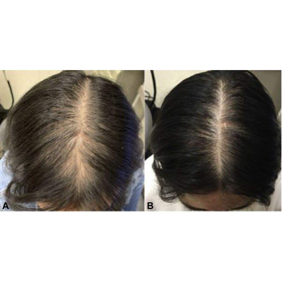 Aceite de Crecimiento Capilar Chebe y Acondicionador Sin Enjuague - 4 oz Crecimiento y 8 oz Acondicionador - Con Manteca de Mango y Aceite de Aguacate