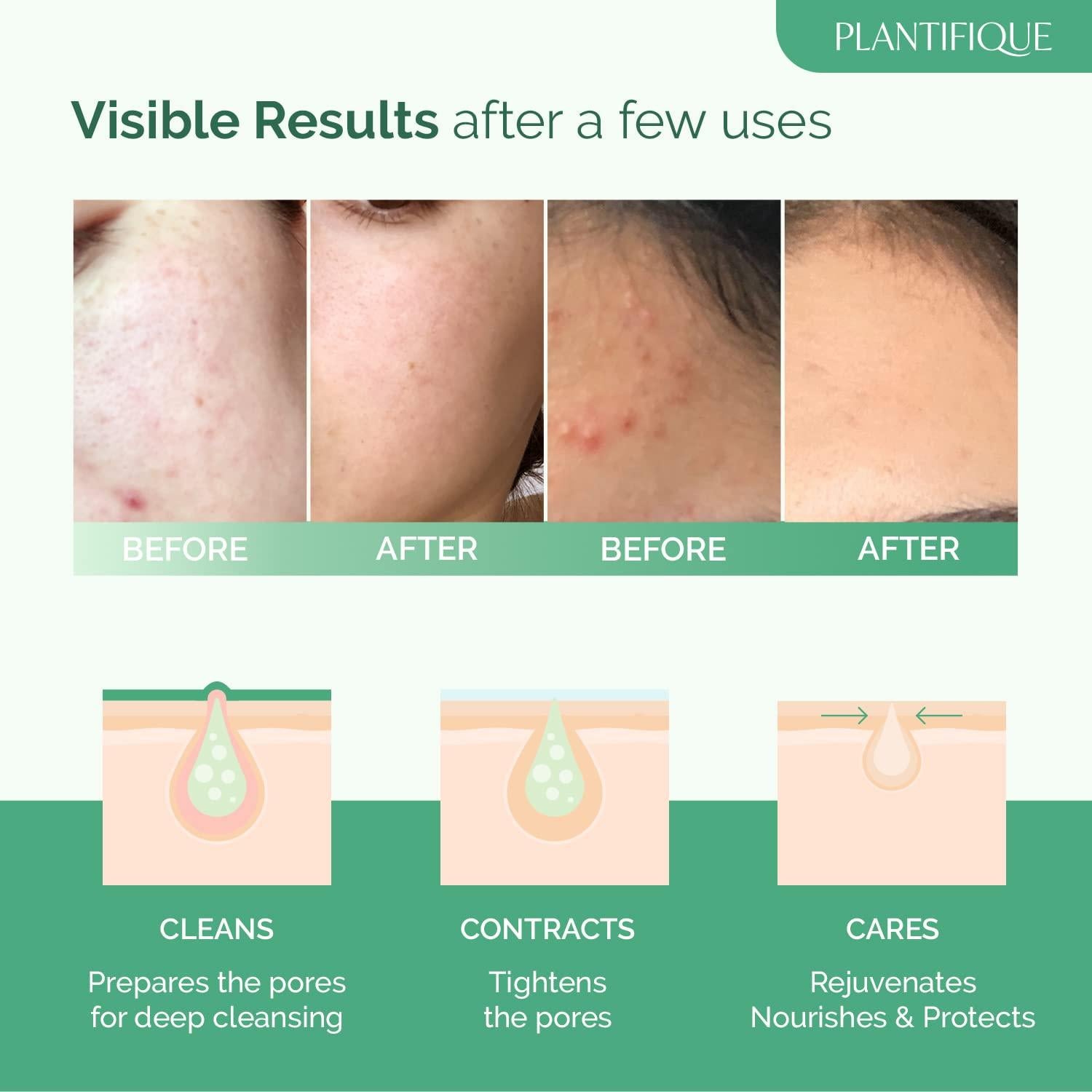 Bálsamo Limpiador Coreano Plantifique con Mango y Papaya 100g