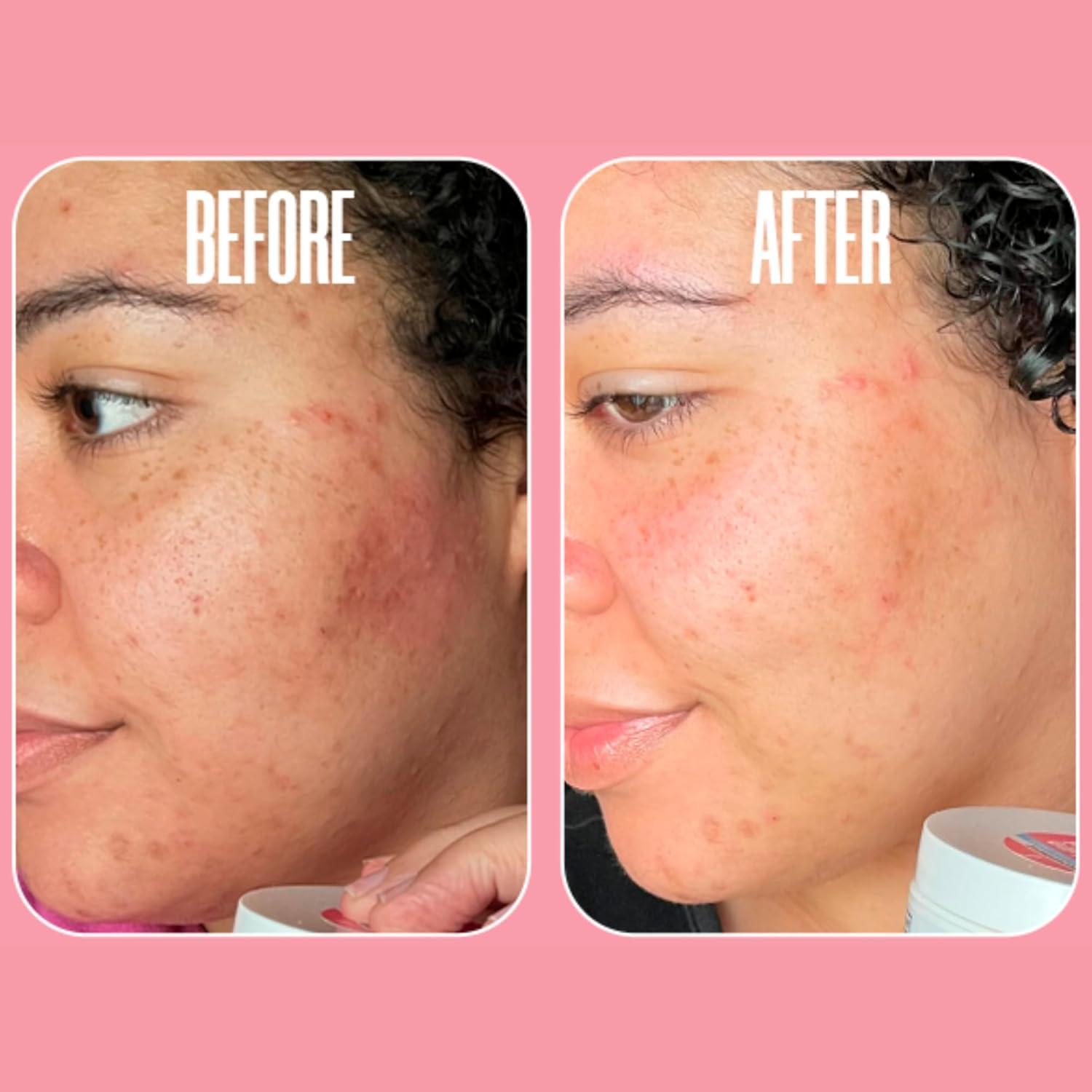 Discos Exfoliantes de Ácido Glicólico Beautiste 50 Unidades