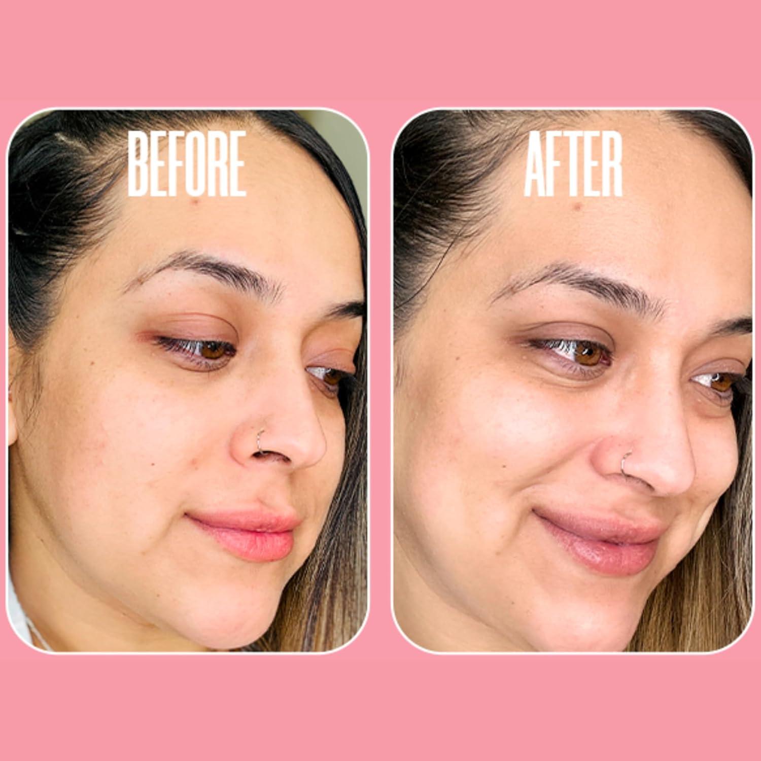 Discos Exfoliantes de Ácido Glicólico Beautiste 50 Unidades