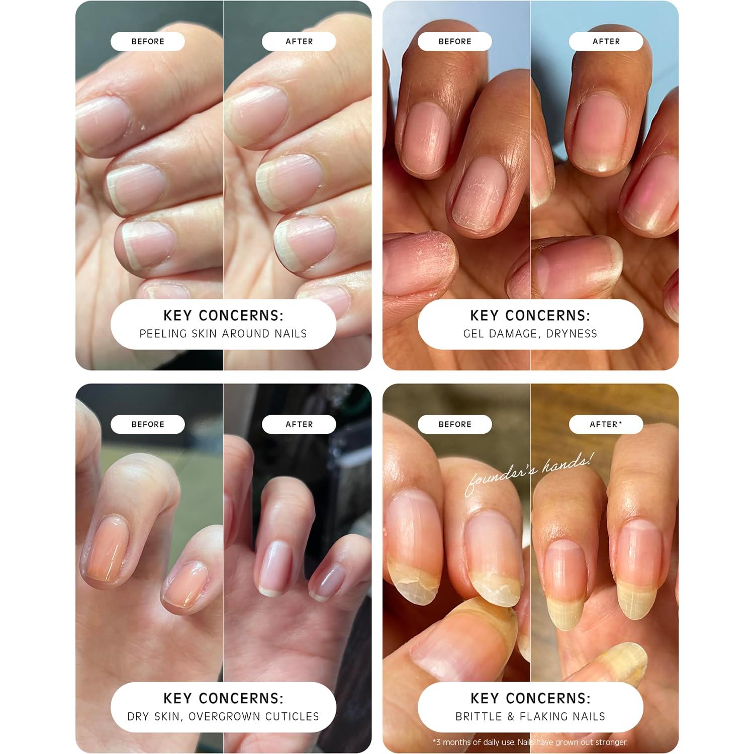 Aceite de Cutícula Diario Vacance 9mL Viaje Antiinflamatorio