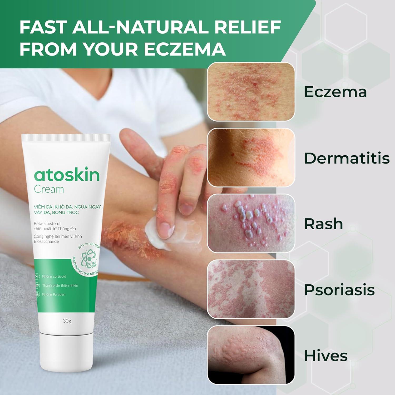 Crema Atoskin para Eczema y Dermatitis - 40.8 g