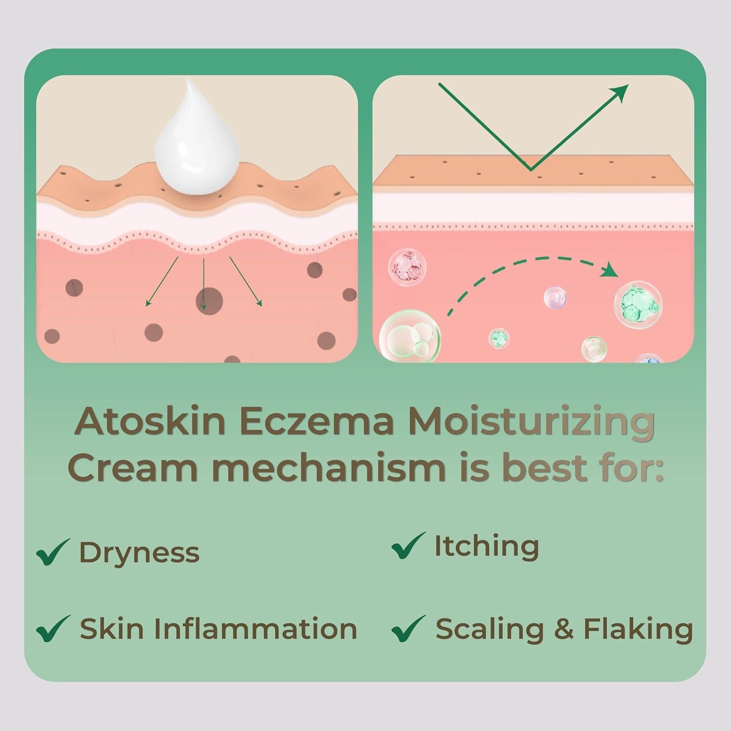 Crema Atoskin para Eczema y Dermatitis - 40.8 g