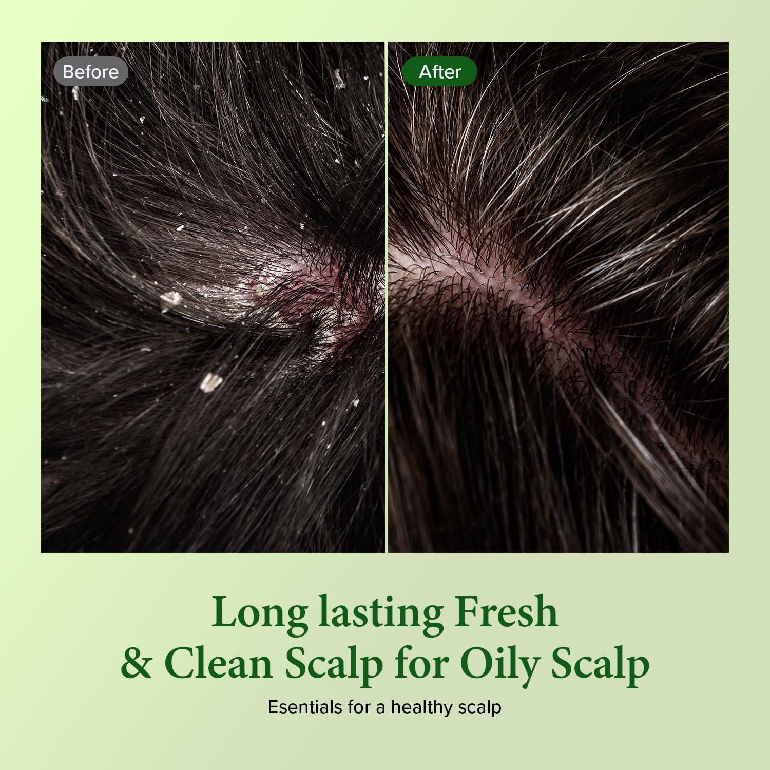 Champú KUNDAL Árbol de Té y Macadamia 300 ml - Paquete de 2