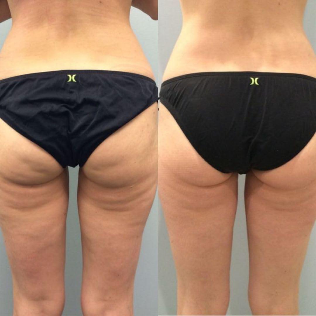 Crema Bum Bum IT 226.8g - Reafirmante y Elevadora para Celulitis