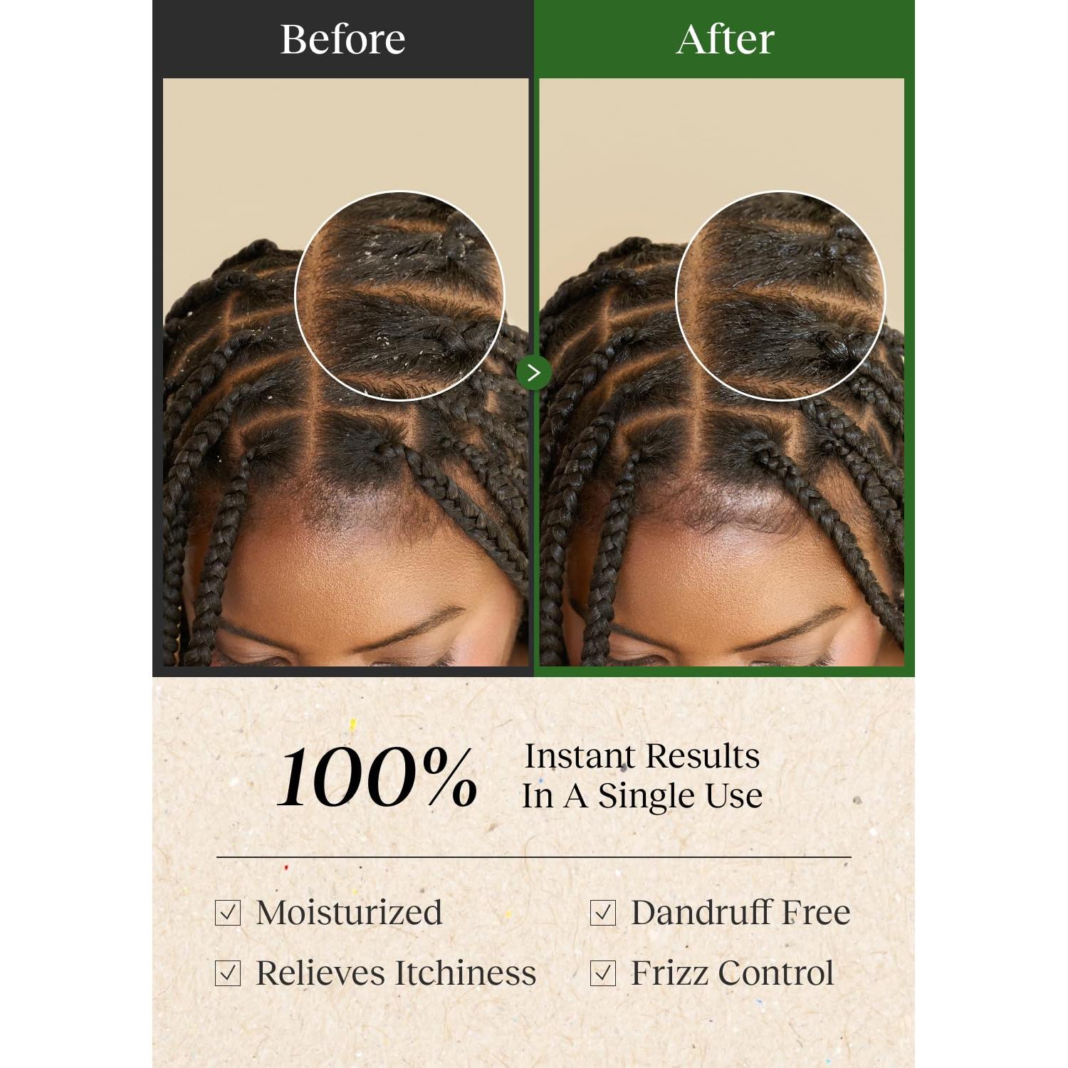 Tónico Limpiador del Cuero Cabelludo Bephor 200ml Sin Enjuague